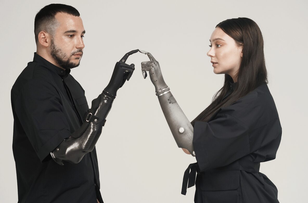 Couple with prothetic arms