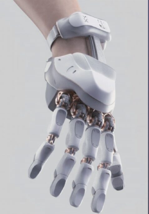 Prosthetic hand