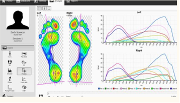 Feet analysis